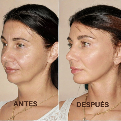 Cepillo facial efecto lifting Lumea